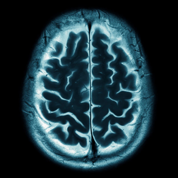 Neurosurgery Brain